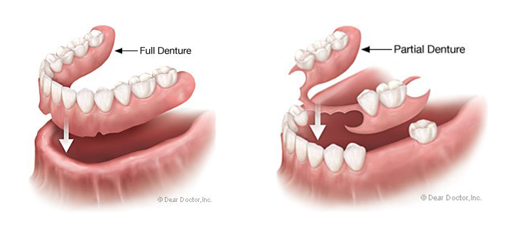 Denture Information Diagram